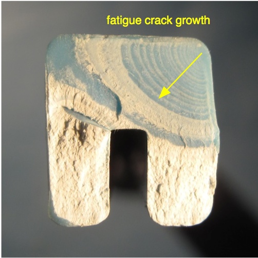 Fracture surface of a plastic arm